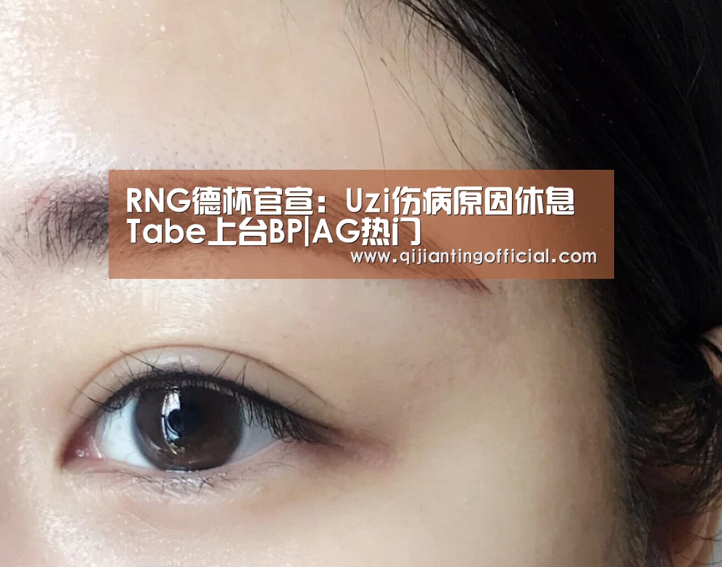 RNG德杯官宣:Uzi伤病原因休息 Tabe上台BP|AG热门(图1) AG官网